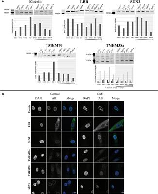 <mark class="highlighted">Nuclear Envelope</mark> Transmembrane Proteins in Myotonic Dystrophy Type 1